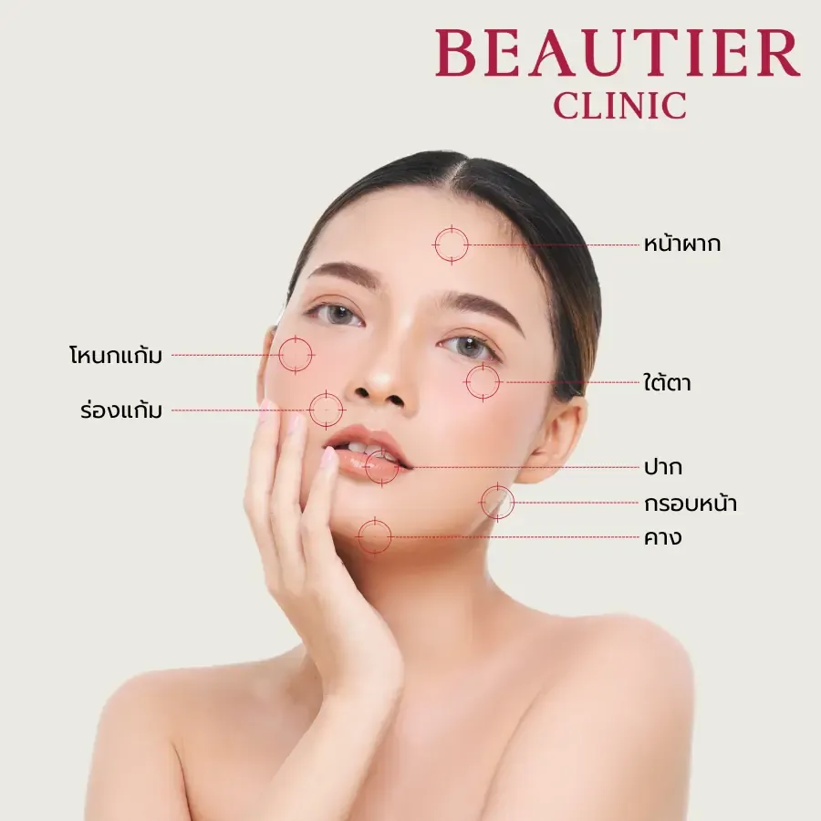 ภาพแสดงตำแหน่งประเมิน Filler บนใบหน้า ได้แก่ หน้าผาก ขมับ ใต้ตา จมูก ร่องแก้ม คาง และปาก