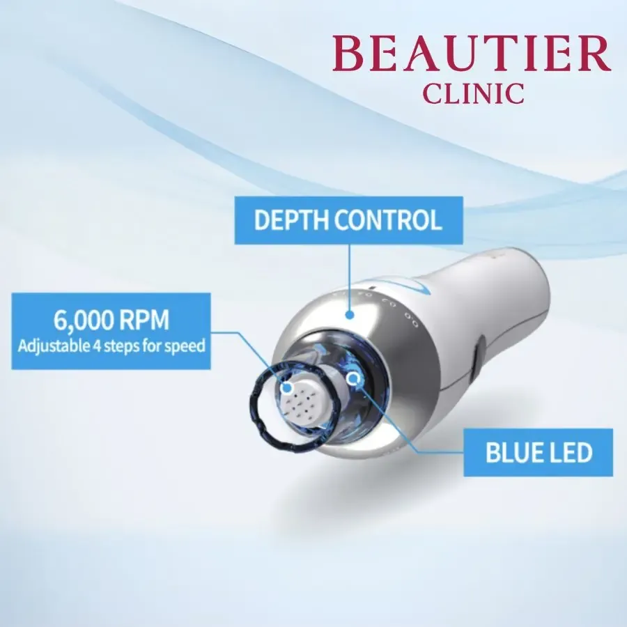 อุปกรณ์ Microneedling Pen ที่ Beautier Clinic ใช้ในโปรแกรมดูแลหลุมสิวและรูขุมขน