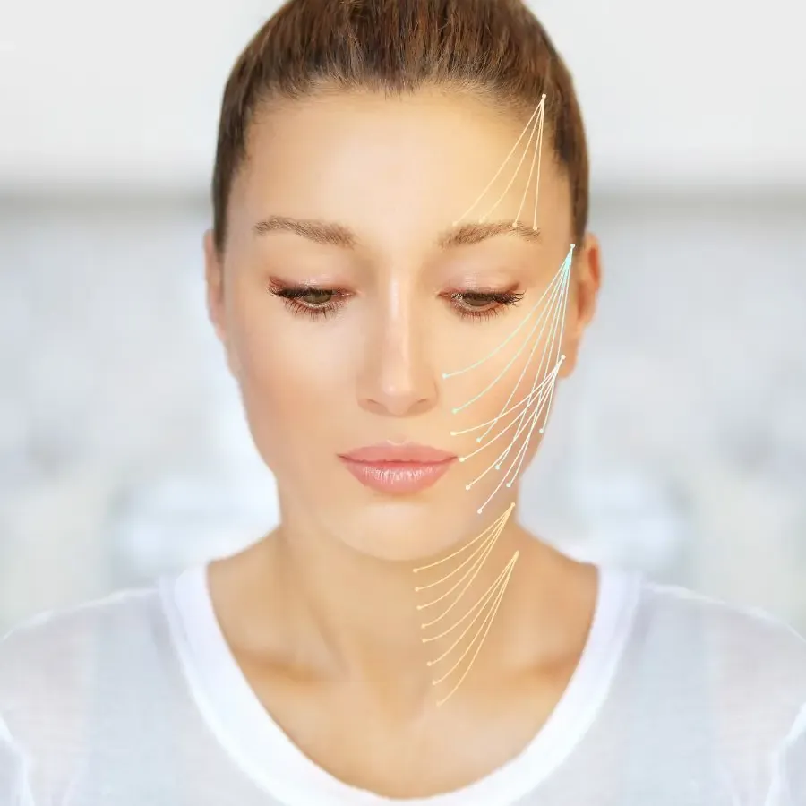 ภาพจำลองแนวกล้ามเนื้อและเส้นประสาทบริเวณใบหน้าสำหรับการวางแผน Botulinum Toxin