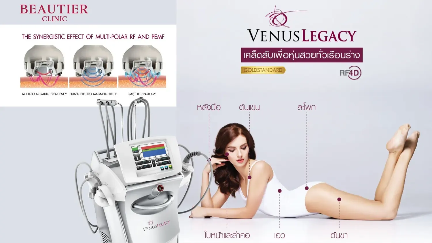 ภาพเครื่อง Venus Legacy กลไก Multi-Polar RF และบริเวณใบหน้า ต้นแขน หน้าท้อง สะโพกและต้นขา